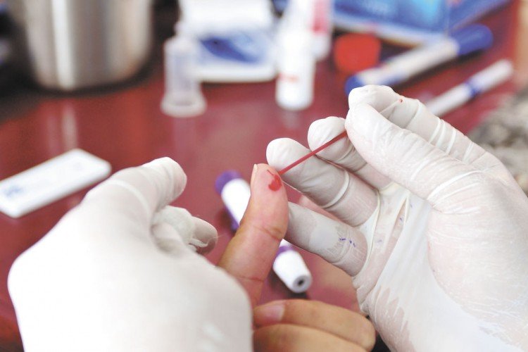 VIH en Nicaragua supera los 11 mil casos